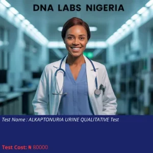 Alkaptonuria Urine Qualitative Test cost NGN 80000