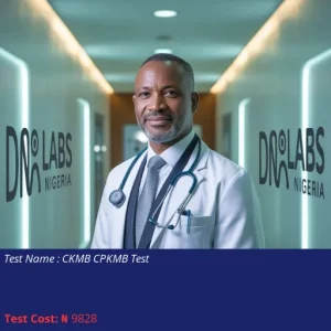 CKMB CPKMB Test cost NGN 9828