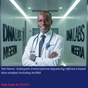 Eukaryotic Transcriptome Sequencing Reference Based Data Analysis Including LncRNA cost NGN 300000