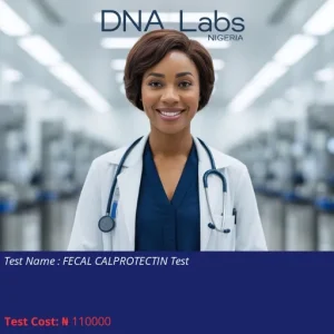 Fecal Calprotectin Test cost NGN 110000