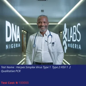 Herpes Simplex Virus Type 1 & Type 2 HSV 1 & 2 Qualitative PCR cost NGN 100000