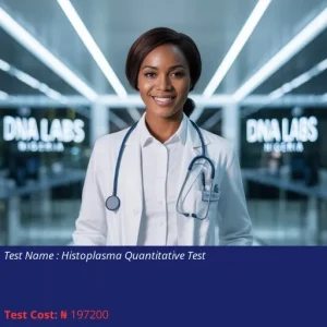 Histoplasma Quantitative Test cost NGN 197200