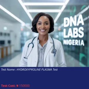 Hydroxyproline Plasma Test cost NGN 150000