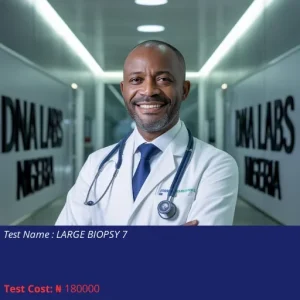 Large Biopsy 7 cost NGN 180000