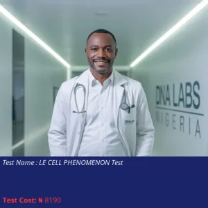 Le Cell Phenomenon Test cost NGN 8190