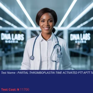 Partial Thromboplastin Time Activated PTT APTT Test cost NGN 11700