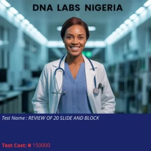 Review of 20 Slide and Block cost NGN 150000