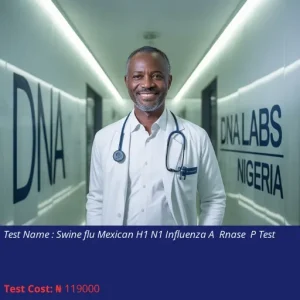 Swine Flu Mexican H1N1 Influenza A Rnase P Test cost NGN 119000