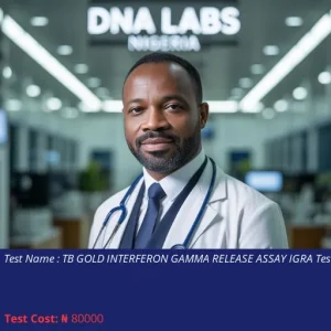 TB Gold Interferon Gamma Release Assay IGRA Test cost NGN 80000