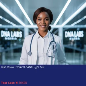 Torch Panel IgG Test cost NGN 30420