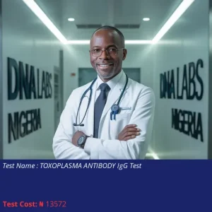 Toxoplasma Antibody IgG Test cost NGN 13572