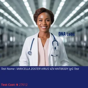Varicella Zoster Virus VZV Antibody IgG Test cost NGN 27612
