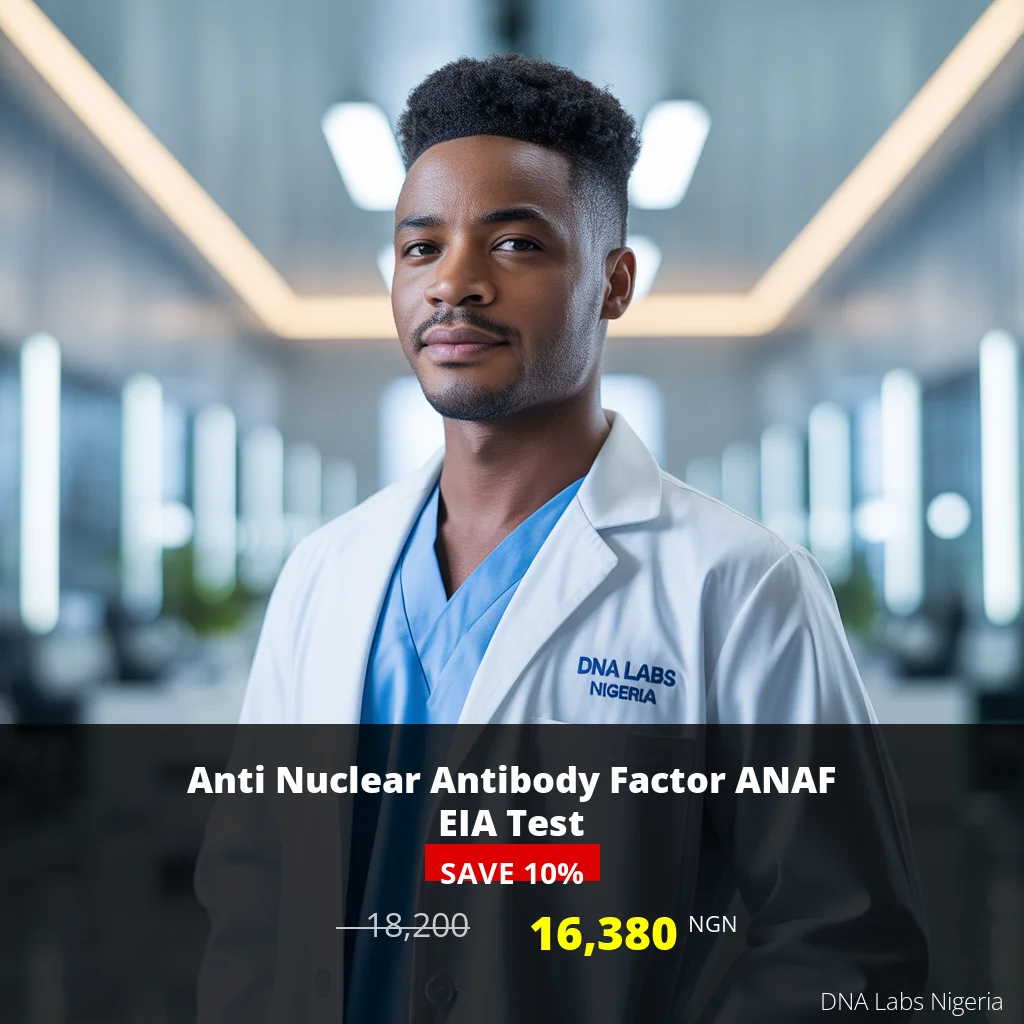 Anti Nuclear Antibody Factor ANAF EIA Test - 16380 NGN - Nigeria