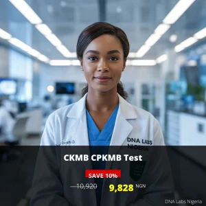CKMB CPKMB Test - Affordable Cardiac Testing in Nigeria for 9828 NGN