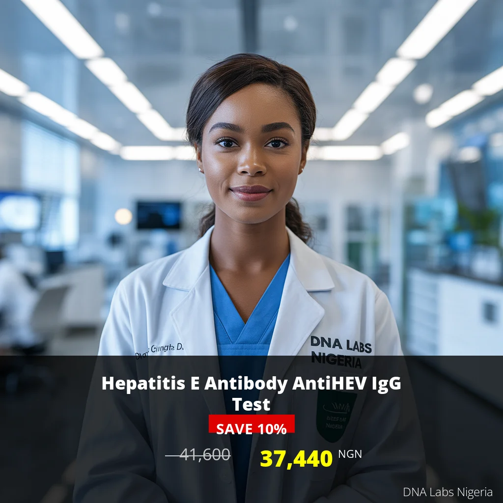 Hepatitis E Antibody AntiHEV IgG Test - 37