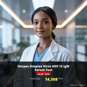 Herpes Simplex Virus HSV 12 IgM Serum Test - 14508 NGN - Nigeria