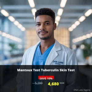 Mantoux Test Tuberculin Skin Test in Nigeria - 5200 NGN