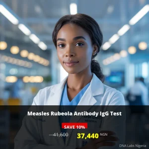 Measles Rubeola Antibody IgG Test - 37