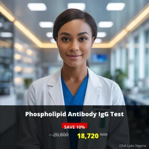 Phospholipid Antibody IgG Test - 20800 NGN - DNA Labs Nigeria