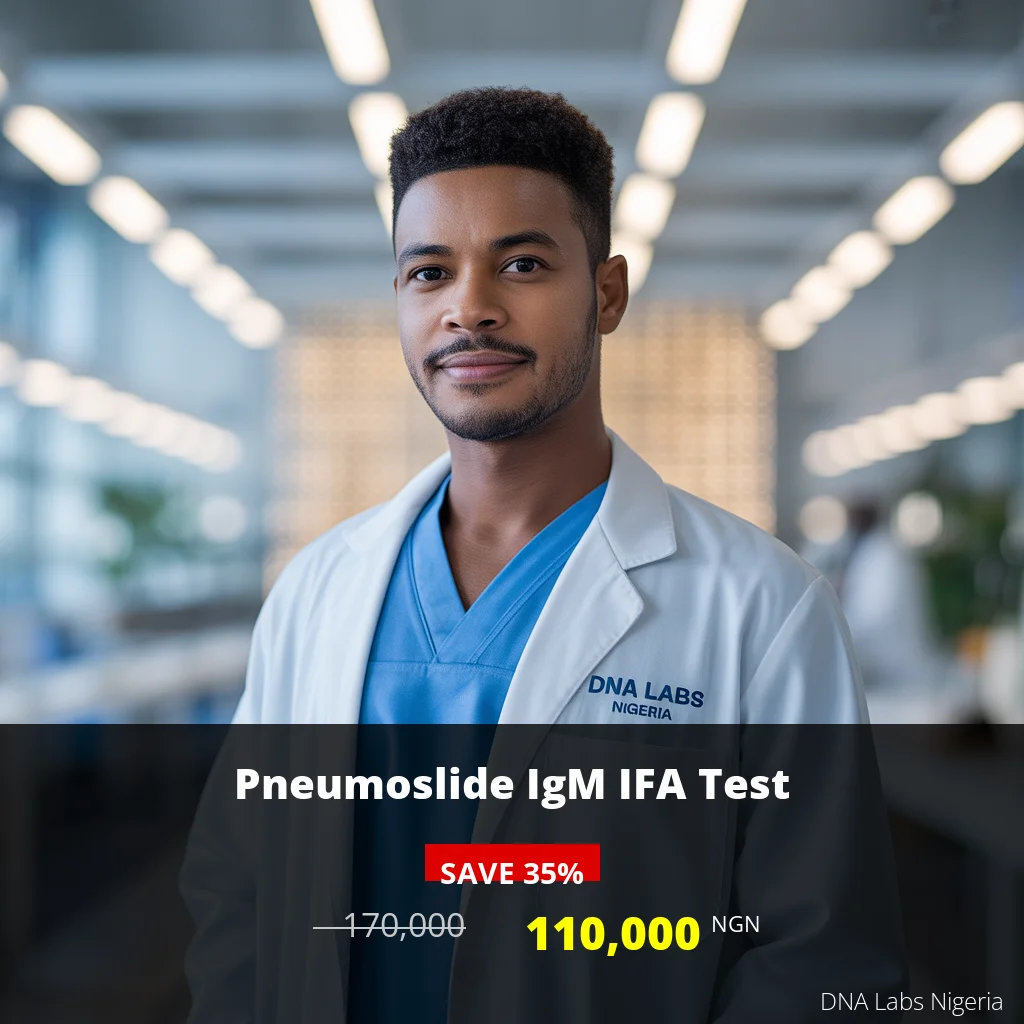 Pneumoslide IgM IFA Test - 110