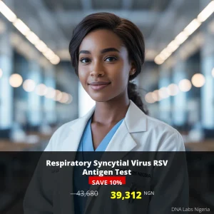Respiratory Syncytial Virus RSV Antigen Test - 39312 NGN - Nigeria