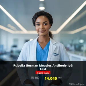 Rubella German Measles Antibody IgG Test - 14
