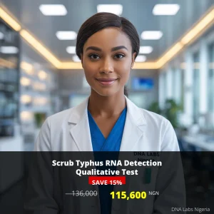 Scrub Typhus RNA Detection Qualitative Test - 115600 NGN - Nigeria