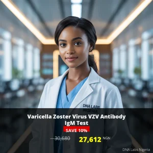 Varicella Zoster Virus VZV Antibody IgM Test - 30