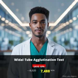 Widal Tube Agglutination Test - 7488 NGN - Nigeria