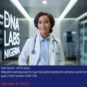 AKT3 Gene Megalencephaly-Polymicrogyria-Polydactyly-Hydrocephalus Syndrome Type 2 NGS Genetic DNA Test cost NGN 400000