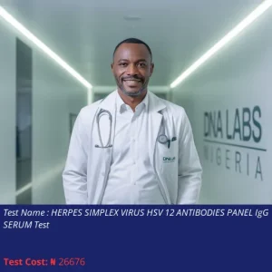 Herpes Simplex Virus HSV 12 Antibodies Panel IgG IgM Serum Test cost NGN 26676