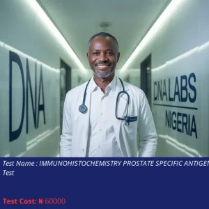 Immunohistochemistry Prostate Specific Antigen PSA Test cost NGN 60000