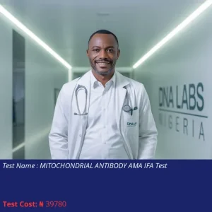 Mitochondrial Antibody AMA IFA Test cost NGN 39780