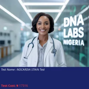 Nocardia Stain Test cost NGN 17316