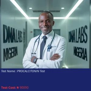Procalcitonin Test cost NGN 90000
