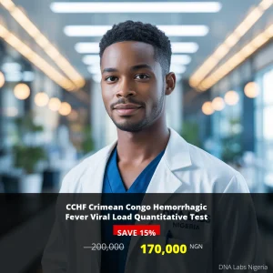CCHF Crimean Congo Hemorrhagic Fever Viral Load Quantitative Test in Nigeria for 200