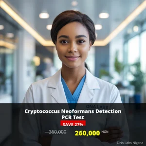 Cryptococcus Neoformans Detection PCR Test - 260