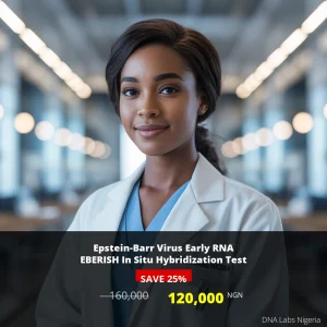 Epstein-Barr Virus Early RNA EBERISH In Situ Hybridization Test - 160000 NGN - Nigeria
