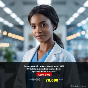 Genexpert Ultra Next Generation MTB With Rifampicin Resistance Semi Quantitative PCR Test - 70000 NGN - Nigeria
