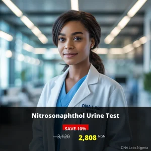 Nitrosonaphthol Urine Test - 3120 NGN - DNA Labs Nigeria