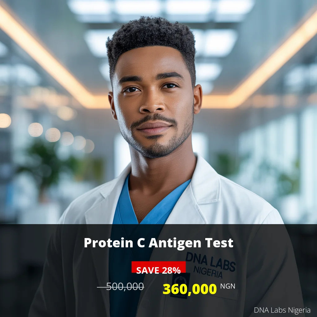 Protein C Antigen Test - 360