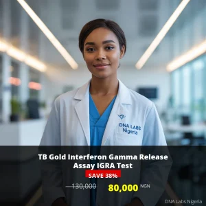 TB Gold Interferon Gamma Release Assay IGRA Test - 80