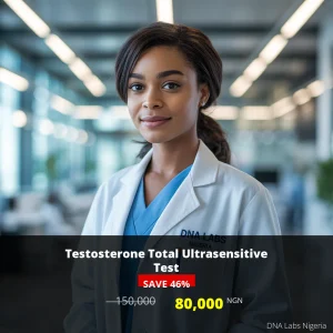 Testosterone Total Ultrasensitive Test - 80