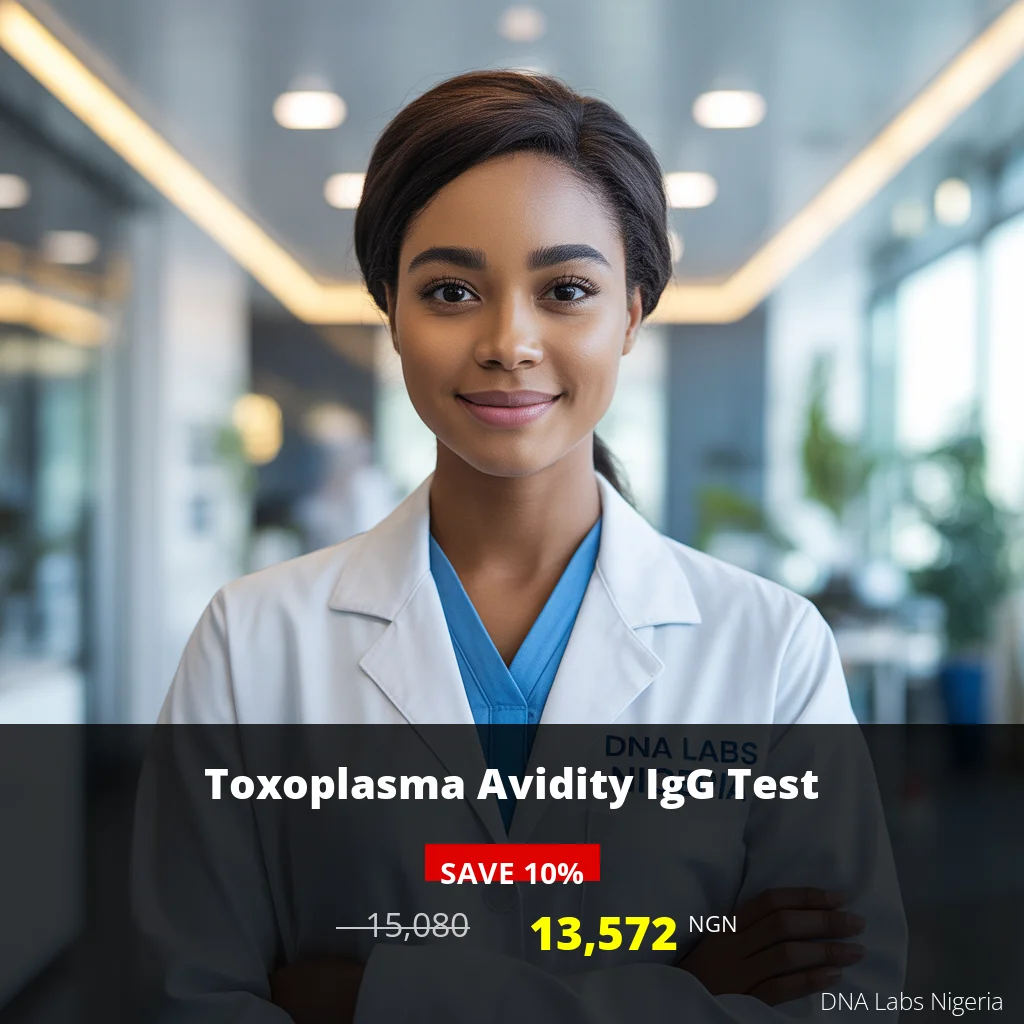 Toxoplasma Avidity IgG Test - 13572 NGN - Nigeria