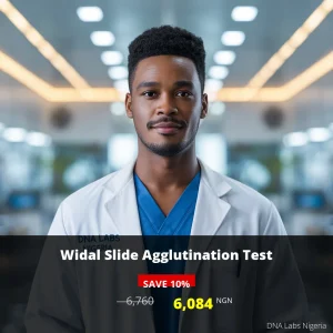 Widal Slide Agglutination Test - 6084 NGN - Nigeria